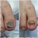 레푸스서초교대역점 | 문제성 발관리는 레푸스 서초교대역점 서초발관리