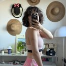 (주) 에이알스포츠(대전점) | 팔뚝지방흡입 한달차 변화과정 후기ㅣ붓기 바본 관리 꿀팁ㅣ대전지방흡입 충주지방흡입