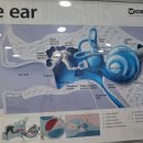 오티콘보청기 강화센터 이미지