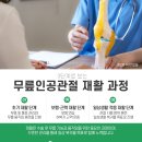 전주신세계정형외과병원 네이버블로그