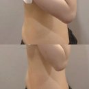 성지테라피 | [대구] 웨딩과 다이어트 성지인 달서구 에스테틱 수미원에서 다이어트 림프테라피 받은 후기