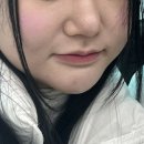 리프팅주사 땡김이주사 턱선관리추천 턱선리프팅후기 무너진턱선이 고민이라면 땡김이주사추천