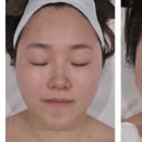 비스킨랩