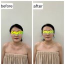 수암초등학교 | [울산 에스테틱샵] 울산 남구 신정동 최지우에스테틱 / 시그니처 작은얼굴 두상밸런스 케어❤️