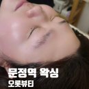 문정역 왁싱 / 울퉁불퉁한 좁은 이마 탈출 헤어라인 정리 잘하는 오롯뷰티
