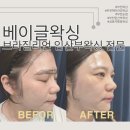 가위사랑헤어아트 | 저통증왁싱 승무원패키지 후기! 부천 상동[베이글왁싱...왁싱 전문] 헤어라인왁싱, 눈썹왁싱, 인중왁싱