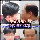 부산가발맞춤가발전문점-30대 남자 부분가발 이미지