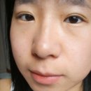 에코라인 이미지