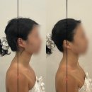 얼라인 | 상현동 에스테틱 용인수지 윤곽관리 얼라인에스테틱 후기