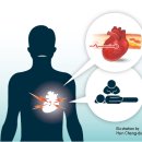Muscle Attack 이미지