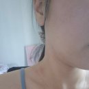 밀가루 끊기 효과 찐후기/ 1년간 나를 괴롭혔던 여드름 박멸 후기(다이어트는 덤)