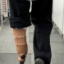 중앙의지보조기 이미지