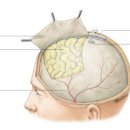 인체해부도 [뇌; BRAIN] 이미지