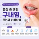 해피스마일치과교정과치과의원 네이버블로그