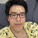 블챌 일상포토덤프]음주 갑작스런 혼절 기절 응급실이용후기; 간질 경련(MRI 뇌 기형 판정)_윌스기념병원