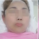 크리스탈피부미용