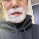 남자 수염 레이저 제모 후기 (영등포 노벨 의원)