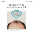 인셀덤보타랩 전혜연