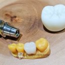 튼튼내이사랑치과의원 이미지