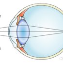 새로봄안경 이미지