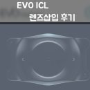 세안안경원 | 부산 렌즈삽입술: evo icl 후방 삽입 렌즈 2일차부터 한달차 후기