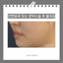 노블성형외과의원 이미지