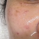 달구벌대로 378길 | 달서구 두류동 문제성 피부 오마카세 관리 블리아뷰티