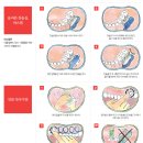 잇몸, 이렇게 관리하세요 이미지
