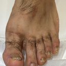 레푸스 평택소사벌점 | 평택 평택무좀발톱, 평택문제성발톱 레푸스 평택역점