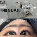 누아(nuah) 네이버블로그