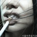 서울바른송치과의원 네이버블로그