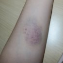 (주)로아메디 | 13. 열매달 이야기