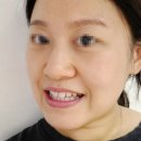 반듯한교정치과기공소 | 안면비대칭 교정은 하고 싶은데, 양악 수술부작용은 싫어요! 방법이 없을까요?