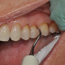 연세스위트치과병원 이미지