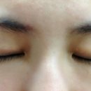 고운피부나라