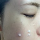 윤약국 | 약국 연고 꿀템 : 기미 여드름 블랙헤드 노스카나 애크린겔 마데카솔 (서울대입구역 약국) 후기