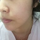 강서 마곡에스테틱 화이트스킨케어 피부관리 후기
