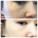 주식회사 제이앤코슈 | 볼륨에센스 사용솔직후기