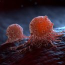 NK메디칼 이미지