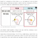 [국내이슈] 병원가서 신속한애들 코까지깊게넣는다ㅋㅋㅋ 증거 이미지