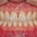 연세화이트치과의원 이미지