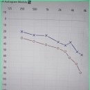 독일보청기 이미지