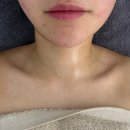 힐미 | 남양주피부관리 추천 스파힐미 윤곽관리 수기관리 후기