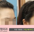 J헤어라인