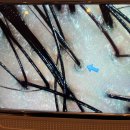 지민1-1 | 명동 미용실 추천 이철헤어커커 명동1호점 지민 리플레니쉬 클리닉 후기