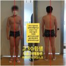 고3 수능생이 두통,어깨통증,허리디스크로 내방하셨어요.(동래구사직동피티)
