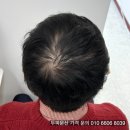 좋은머리좋은두피서귀포점 | 노원 smp 정수리 두피문신 가격과 후기 좋은 곳 (ft.머리문신)