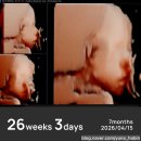 26-D | 26W3D | 임신 26주차 임당 입초 검사 후기(임신성당뇨 입체초음파)