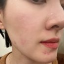 바른메딕스 | 세라메딕스 캡슐 세럼 30대 직장인 실사용 후기 💧🧴