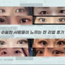 제나성형외과의원 네이버블로그